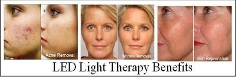 LEd Light Therapy Benefits San Clemente CA
